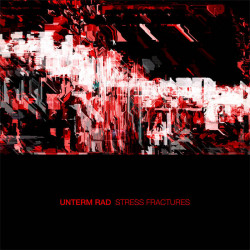 Stress Fractures