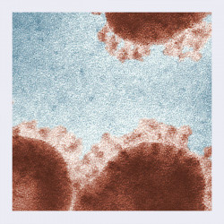 Virus