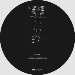 Unforeseen Cervical